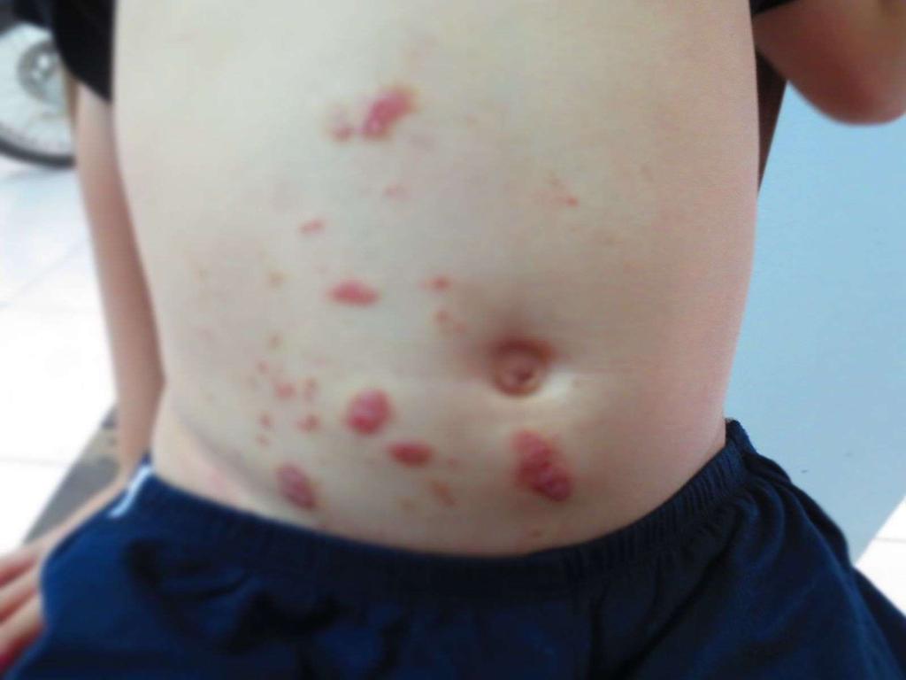 Chó bị nhiễm sán