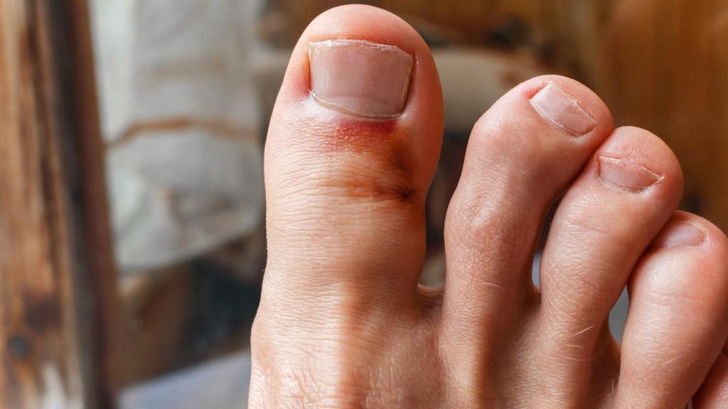chó gãy chân dấu hiệu